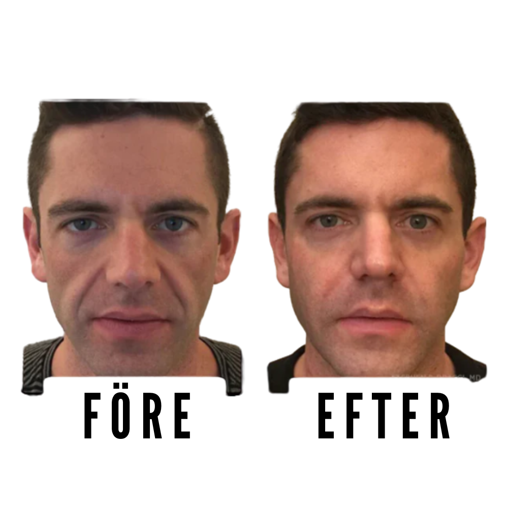 Forge™ - Fastare hud på naturlig väg utan dyra alternativ