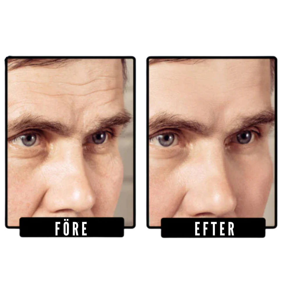 Forge™ - Fastare hud på naturlig väg utan dyra alternativ