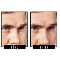 Forge™ - Fastare hud på naturlig väg utan dyra alternativ